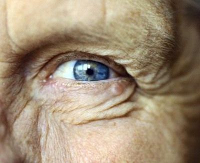 Plástica Ocular e Vias lacrimais